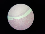 MISSING THUMBNAIL